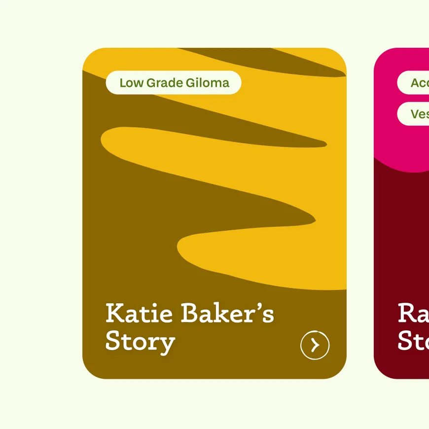 Story component card for Katie Baker and her low grade giloma story.